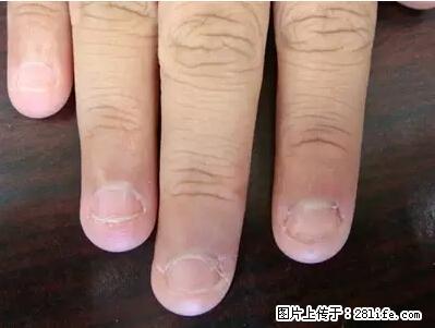 剪指甲、挖耳屎,这些日常小动作竟隐藏大危害! - 通化生活资讯 - 通化28生活网 th.28life.com